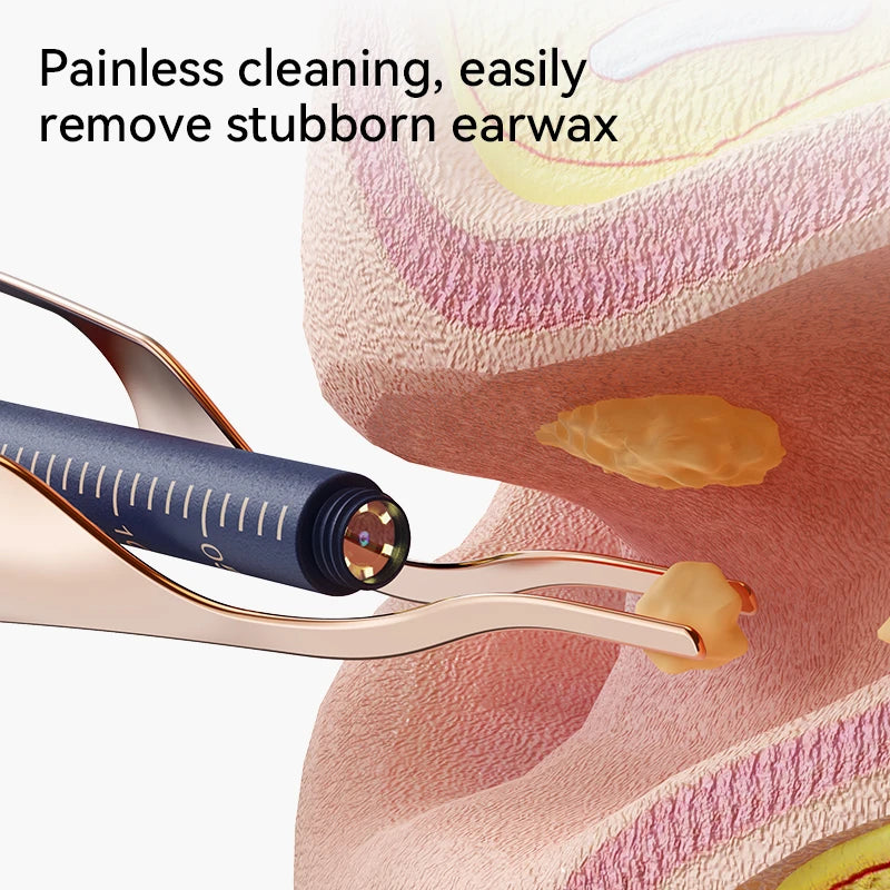 Multi-Functional Visual Ear Cleaning Tool