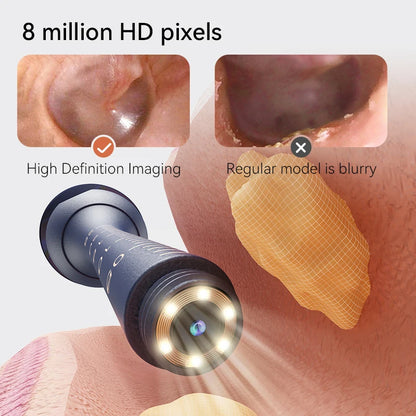Multi-Functional Visual Ear Cleaning Tool