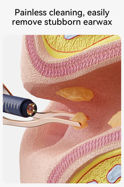 Multi-Functional Visual Ear Cleaning Tool